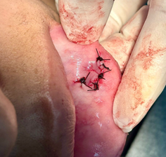 Tatuaje en el brazo de una persona

Descripción generada automáticamente con confianza baja